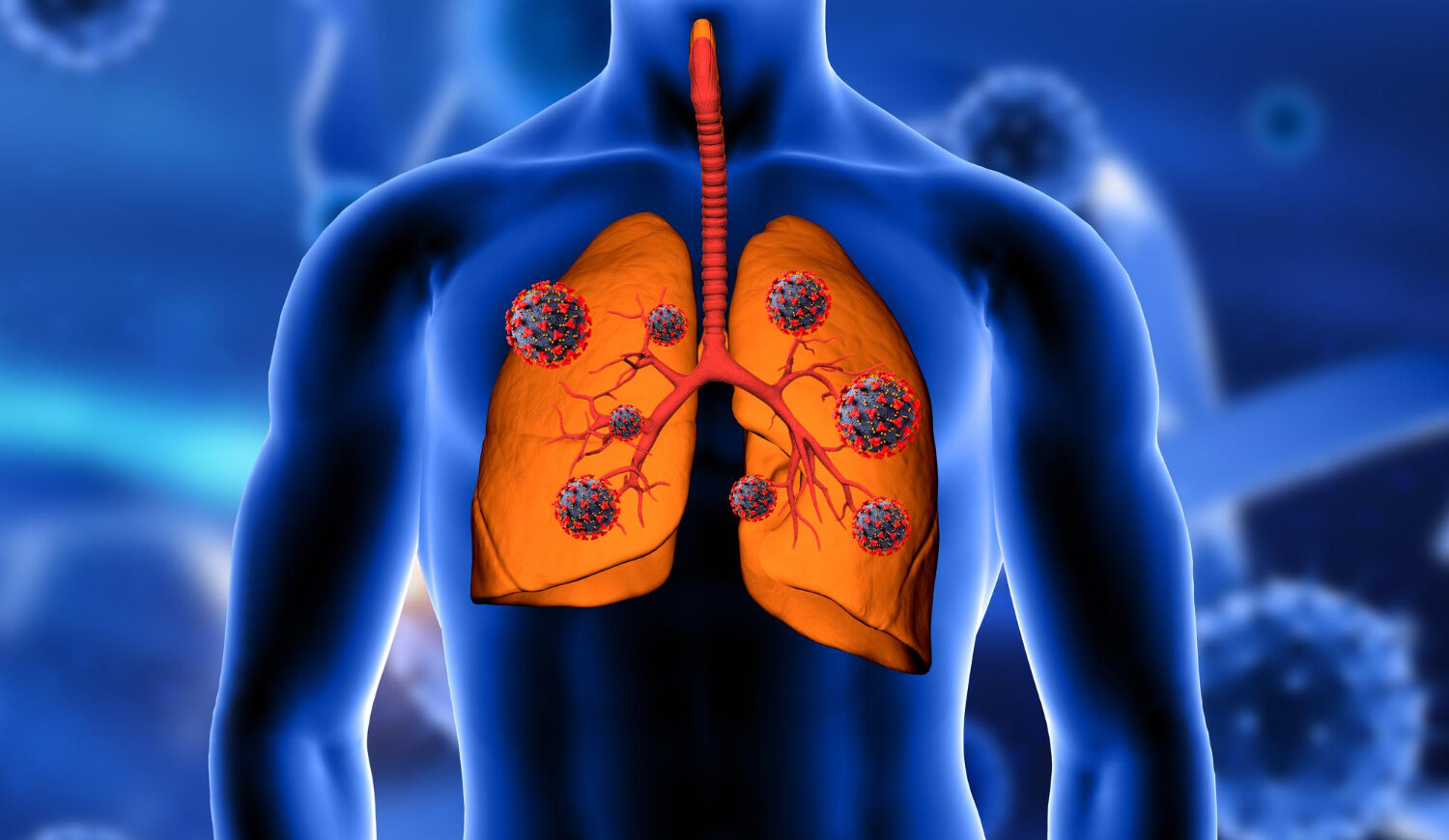 Interstitial Lung Disease